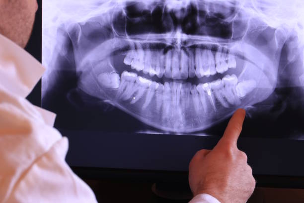 Best Emergency Treatment for Toothache in Berkley, CO