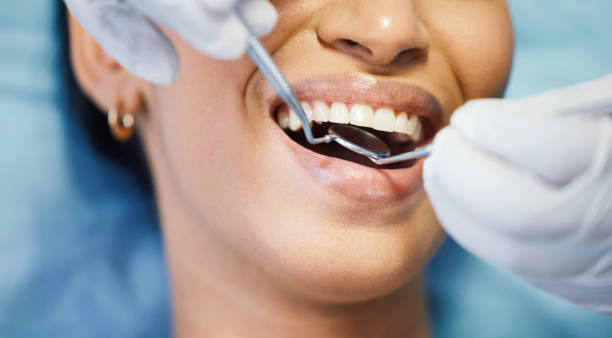 Best Emergency Broken Tooth Repair in Berkley, CO